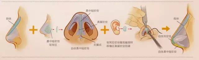 鼻梁翘,颜值爆!