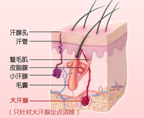 除腋臭原理图