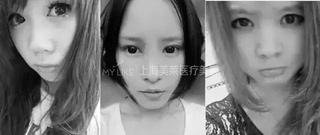 鼻梁翘,颜值爆!