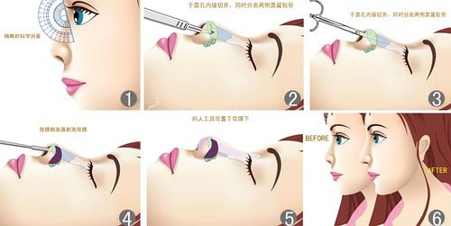 鼻梁翘,颜值爆!