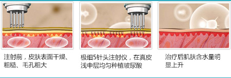 关于水光——做水光,水润过年啦!