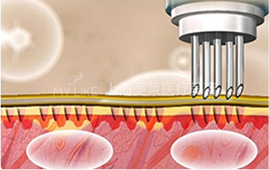 关于水光——做水光,水润过年啦!