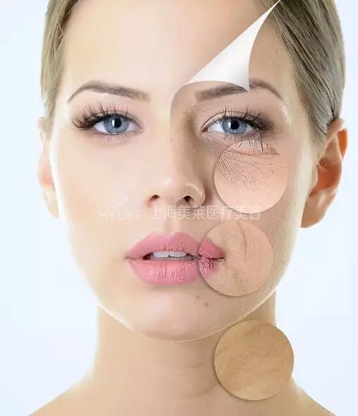 别等皮肤这样了,才想起打水光